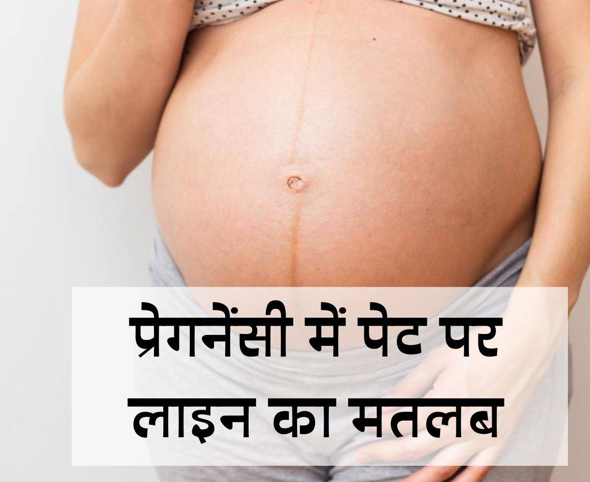 Meaning of lines on stomach during pregnancy