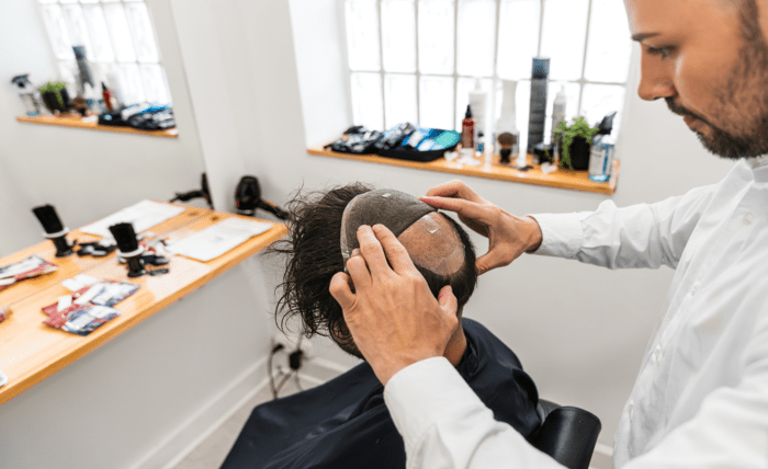 Best Hair Replacement for Men: Non-Surgical vs Surgical Options